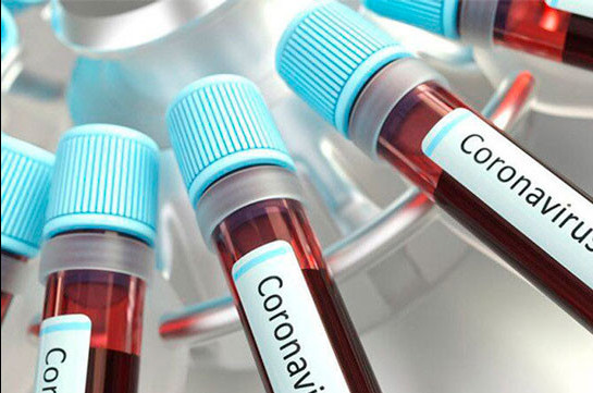 Artsakh records no new coronavirus case in the past day