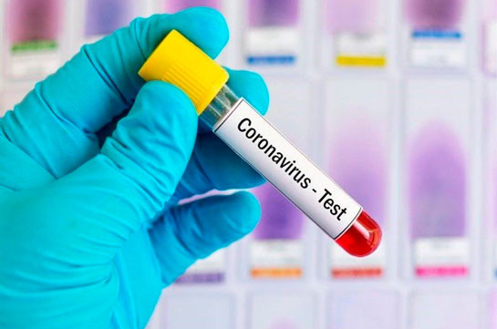 Number of coronavirus cases in Armenia grows by 158 in a past day, 8 new deaths reported