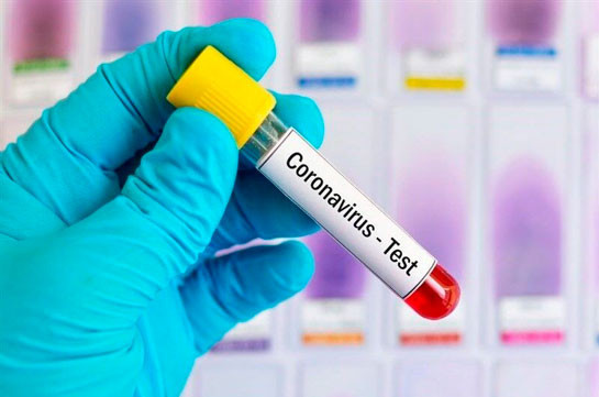 Number of coronavirus cases in Armenia grows by 111 in a past day, 8 new deaths reported