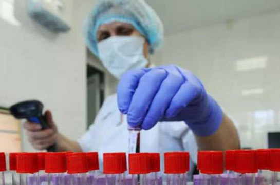 В Армении число зараженных коронавирусом увеличилось на 257, скончались 3 человека