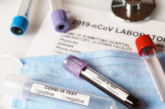 Georgia reports 187 new coronavirus cases, 116 in Adjara region