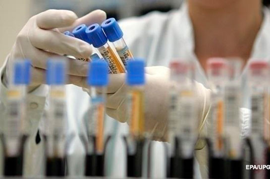 ВОЗ: Создан самый быстрый и дешевый тест на коронавирус
