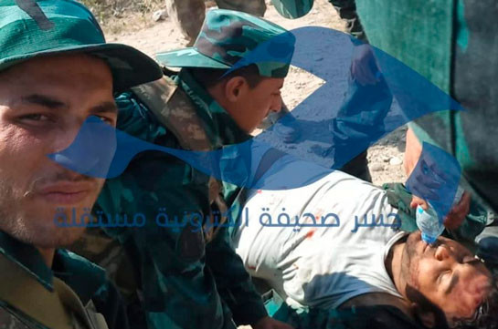 Jesr Press опубликовало первую фотографию раненого в Карабахе наемника из состава «Сирийской национальной армии»