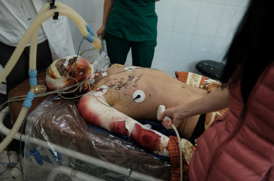 Последствия преднамеренной бомбежки Азербайджаном мирного населения и больниц Арцаха (Фото)