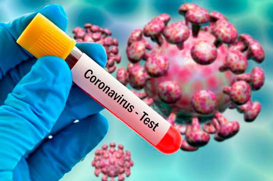 В Армении число зараженных коронавирусом увеличилось на 1042, скончались 23 человека