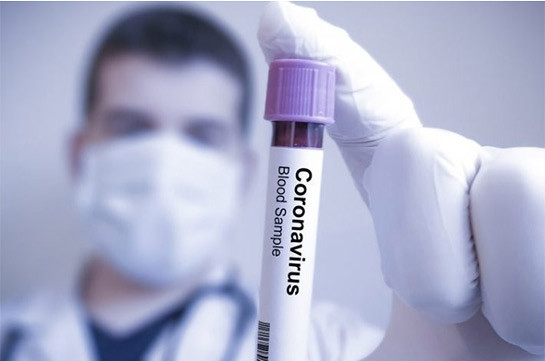 Число инфицированных COVID-19 в мире превысило 106 млн - университет Хопкинса