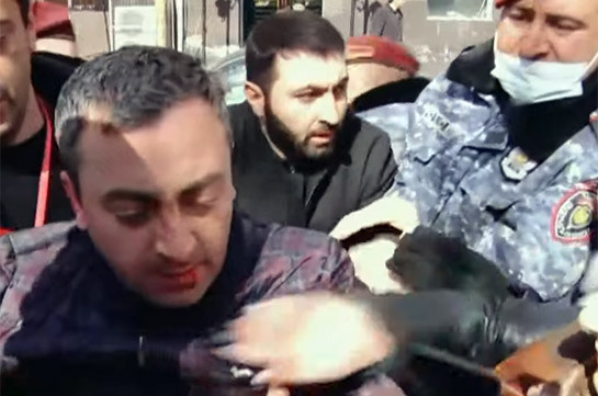 Полицейские в Ереване избили координатора оппозиционного движения Ишхана Сагателяна (Видео)