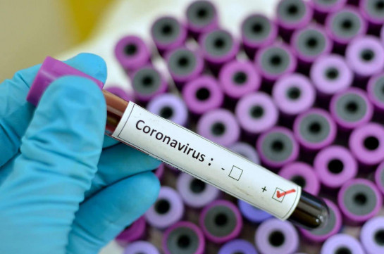 Armenia records 442 new coronavirus cases in a day