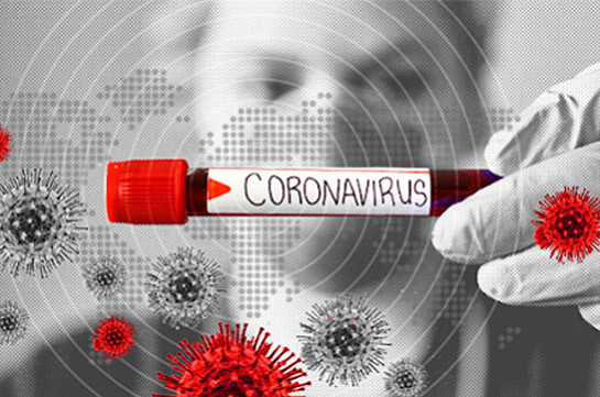 В Армении число зараженных коронавирусом увеличилось на 1009, скончался 31 человек