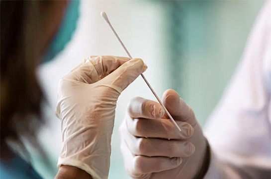 В Арцахе выявлено 11 новых случаев заражения коронавирусом