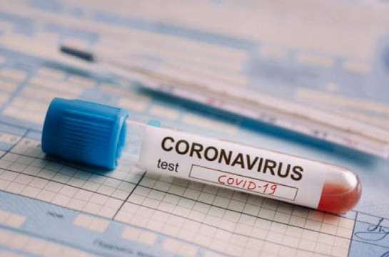 В Арцахе выявлено 9 новых случаев заражения коронавирусом