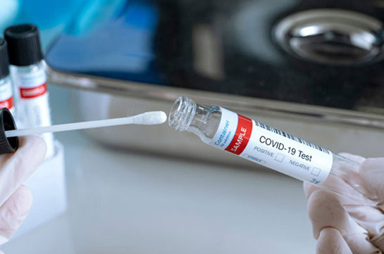 В Арцахе выявлено четыре новых случая заражения коронавирусом