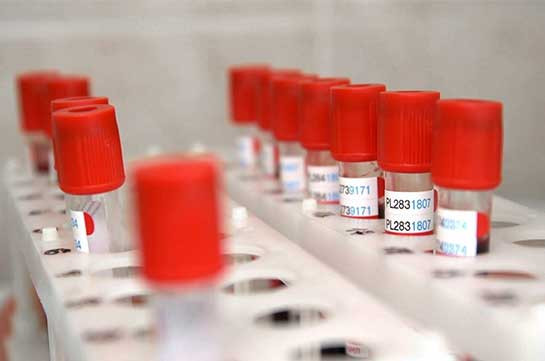 Armenia documents 55 new coronavirus cases in 24 hours, 3 deaths recorded