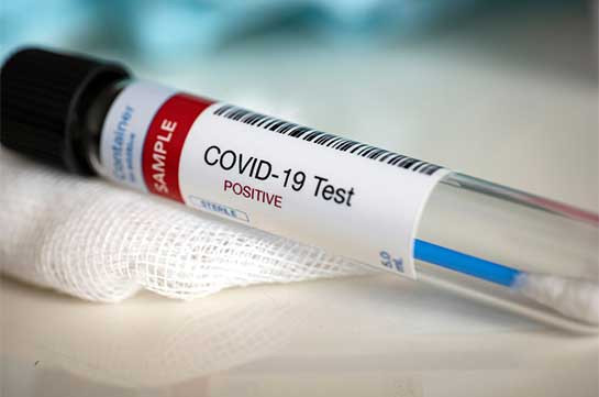 Armenia documents 182 new coronavirus cases in 24 hours, 2 deaths recorded
