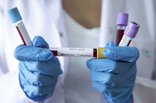 В Арцахе выявили 4 случая заражения коронавирусом