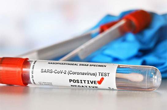 В Арцахе выявили 2 случая заражения коронавирусом