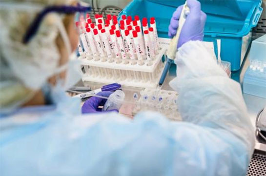 В Арцахе выявили 5 новых случаев заражения коронавирусом