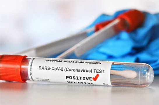 В Арцахе выявили 4 случая заражения коронавирусом