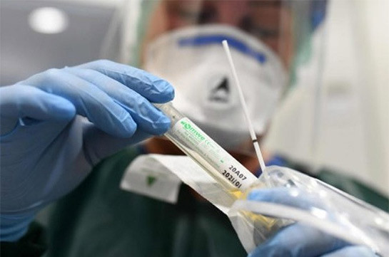 В Арцахе выявлен 21 случай заражения коронавирусом