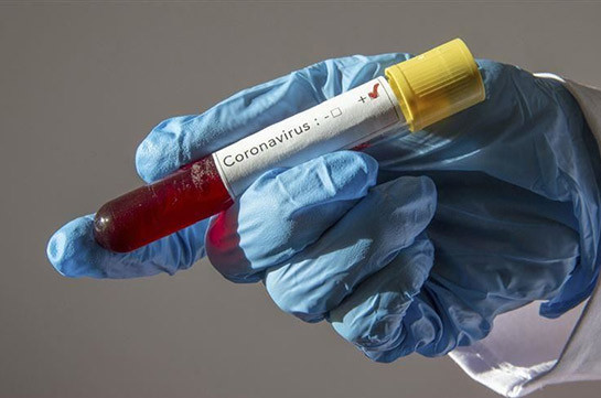 В Арцахе выявлены 35 случаев заражения коронавирусом