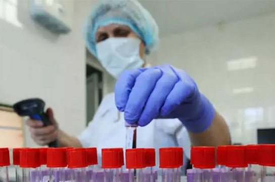 В Арцахе выявлены 34 случая заражения коронавирусом, скончался один человек