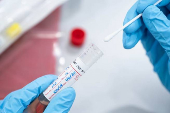 В Арцахе подтверждено 7 случаев заражения коронавирусом