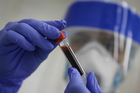 В Арцахе подтверждено 9 новых случаев заражения коронавирусом