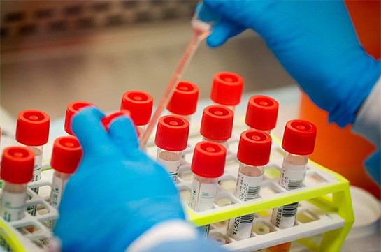 В Арцахе подтверждено 19 новых случаев заражения коронавирусом, скончался 1 человек