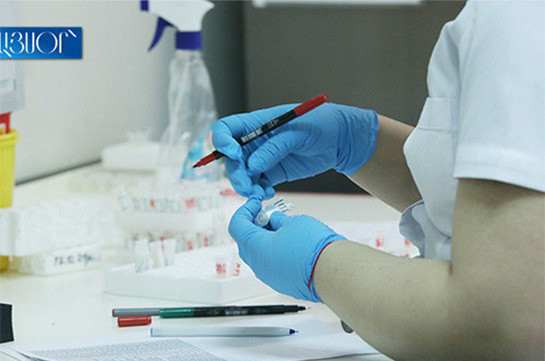 В Арцахе подтверждено 45 новых случаев заражения коронавирусом