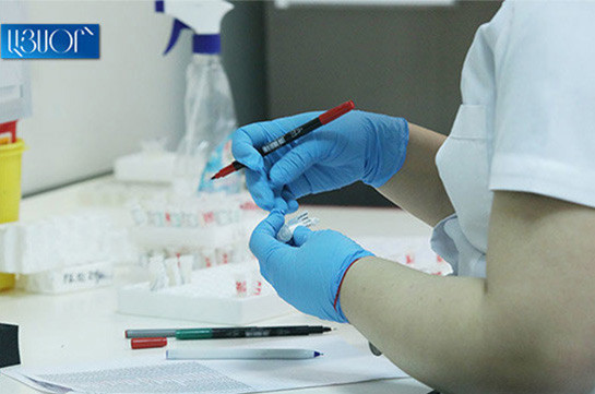 Հայաստանում արձանագրվել է 4 մահ. հաստատվել է կորոնավիրուսային հիվանդության 21 նոր դեպք