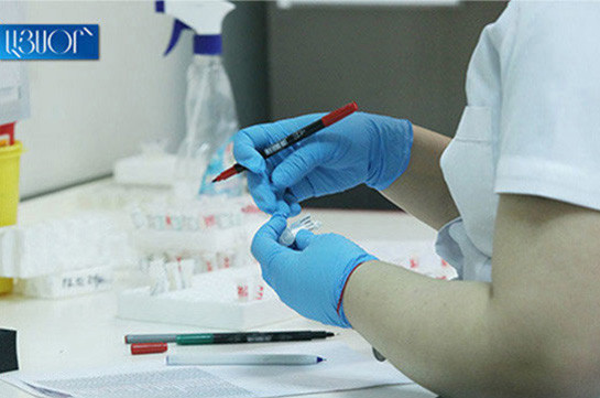 В Армении выявлено 13 новых случаев заражения коронавирусом