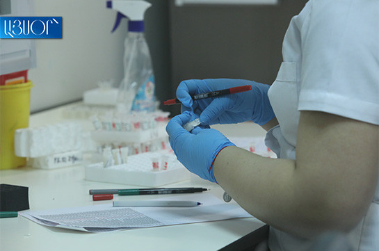 В Армении выявлено 3 новых случая заражения коронавирусом