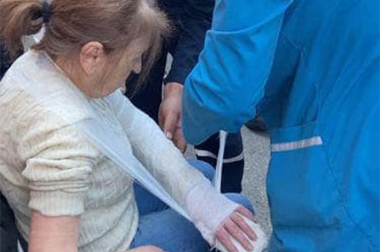 В результат применения полицией грубой и несоразмерной силы сломана рука 77-летней женщины – Айк Мамиджанян представил сообщение