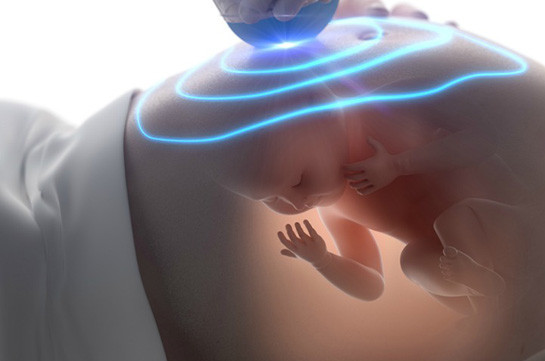 Ի՞նչ կարևորություն ունի դոպլեր հետազոտությունը հղիության ընթացքում
