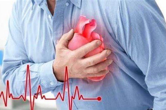 Սրտային հեղձուկ. Ի՞նչ օգնություն ցուցաբերել հիվանդին հևոցի սրման պարագայում