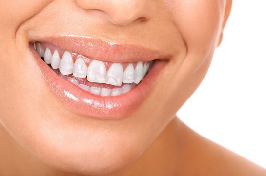 Ատամների վրա առաջացող սպիտակ բծեր. Պատճառներ և բուժման եղանակներ