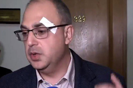 Мгер Саакян подошел к Владимиру Варданяну и ударил каким-то предметом: СК Армении представил подробности
