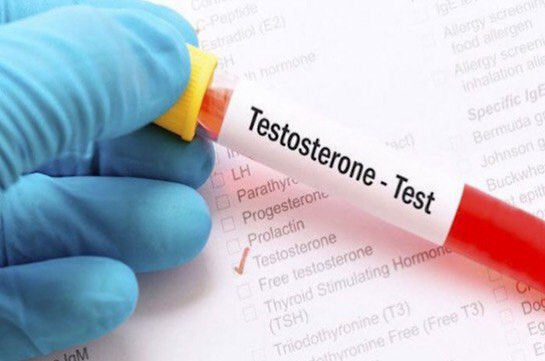 Ե՞րբ է անհրաժեշտ  հանձնել տեստոստերոն հորմոնի մակարդակը որոշող թեստ